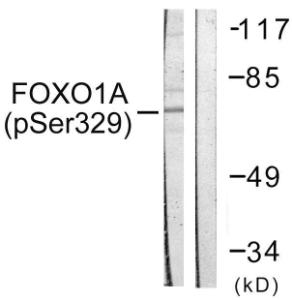 Western blot analysis of lysates from HeLa cells treated with Serum 20% 15' using Anti-FOXO1A (phospho Ser329) Antibody The right hand lane represents a negative control, where the antibody is blocked by the immunising peptide