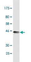 Anti-TTK Mouse Monoclonal Antibody [clone: X1]