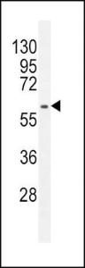 Anti-MDM2 Rabbit Polyclonal Antibody (AP (Alkaline Phosphatase))