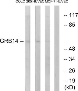 Western blot analysis of lysates from HUVEC, COLO, and MCF-7 cells using Anti-GRB14 Antibody. The right hand lane represents a negative control, where the antibody is blocked by the immunising peptide.