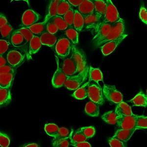 Antibody anti-cytokeratin 18 DA7 100 µg