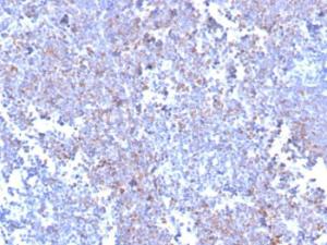 Anti-SOX11 Rabbit Recombinant Antibody [clone: SOX11/3235R]