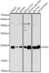 Western blot analysis of extracts of various cell lines, using Anti-SSR2 Antibody (A305691) at 1:1,000 dilution