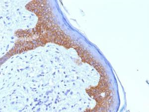 Immunohistochemical analysis of formalin-fixed, paraffin-embedded human skin using Anti-Desmoglein 3 Antibody [5G11]