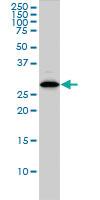 Anti-CLIC1 Mouse Monoclonal Antibody [clone: 2D4]