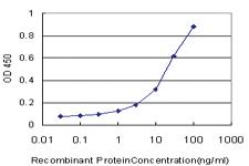 Anti-MARCH6 Mouse Monoclonal Antibody [clone: 2F7]