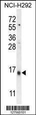 Anti-LY6G6C Rabbit Polyclonal Antibody (AP (Alkaline Phosphatase))