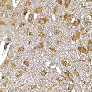 Immunohistochemistry analysis of paraffin-embedded mouse spinal cord using Anti-IRS1 Antibody (A12569) at a dilution of 1:100 (40x lens). Perform high pressure antigen retrieval with 10 mM citrate buffer pH 6.0 before commencing with IHC staining protocol.