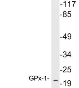 Western blot analysis of lysates from THP 1 cells using Anti-GPx-1 Antibody