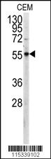 Anti-PKM Rabbit Polyclonal Antibody