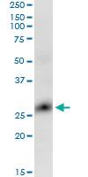 Anti-GLIPR1 Mouse Monoclonal Antibody [clone: 8D9]