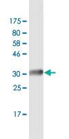 Anti-ELANE Mouse Monoclonal Antibody [clone: 4E11]