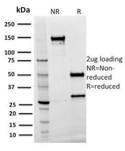 SDS-PAGE analysis of Anti-Spastin Antibody [Sp 3G11-1] under non-reduced and reduced conditions; showing intact IgG and intact heavy and light chains, respectively. SDS-PAGE analysis confirms the integrity and purity of the antibody.