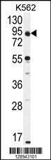 Anti-PPP1R21 Rabbit Polyclonal Antibody (APC (Allophycocyanin))