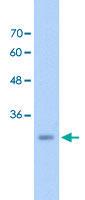 Anti-GEM Rabbit Polyclonal Antibody