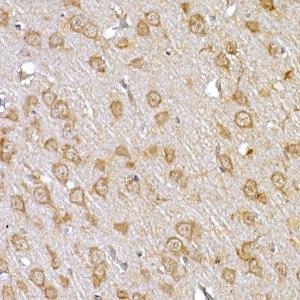 Immunohistochemistry analysis of paraffin-embedded rat brain using Anti-IRS1 Antibody (A12569) at a dilution of 1:100 (40x lens). Perform high pressure antigen retrieval with 10 mM citrate buffer pH 6.0 before commencing with IHC staining protocol.