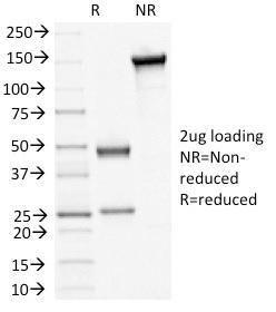 SDS-PAGE analysis of Anti-Desmoglein 3 Antibody [5H10] under non-reduced and reduced conditions; showing intact IgG and intact heavy and light chains, respectively. SDS-PAGE analysis confirms the integrity and purity of the antibody.