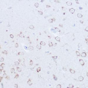 Immunohistochemistry analysis of paraffin-embedded mouse brain using Anti-SSR2 Antibody (A305691) at a dilution of 1:100 (40X lens). Perform high pressure antigen retrieval with 10 mM citrate buffer pH 6.0 before commencing with IHC staining protocol