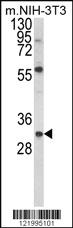 Anti-UBE2J1 Rabbit Polyclonal Antibody