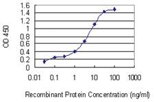 Anti-GLIPR1 Mouse Monoclonal Antibody [clone: 8D9]