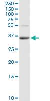 Anti-PPAP2A Rabbit Polyclonal Antibody