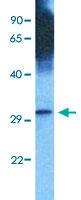 Anti-GEM Rabbit Polyclonal Antibody