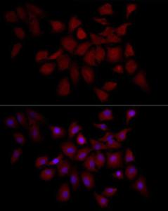 Immunofluorescence analysis of A-549 cells using Anti-IRS1 Antibody (A12569) at a dilution of 1:100 (40x lens). DAPI was used to stain the cell nuclei (blue).