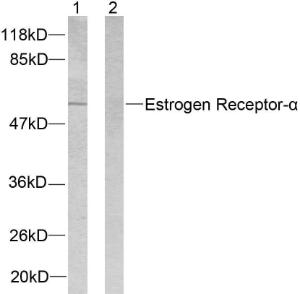 Anti-Estrogen Receptor alpha Rabbit Polyclonal Antibody