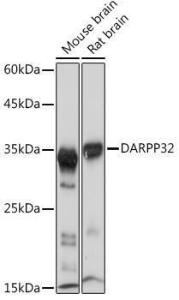 Western blot analysis of extracts of various cell lines, using Anti-DARPP32 Antibody [ARC2095] (A307157) at 1:1,000 dilution