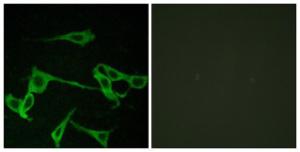 Antibody anti-HRH2 A101423-100 100 µg