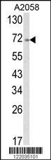 Anti-ATF6 Rabbit Polyclonal Antibody