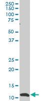 Anti-SNAPC5 Mouse Monoclonal Antibody [clone: 5C3]