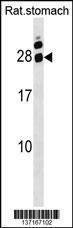 Anti-HOXA5 Rabbit Polyclonal Antibody