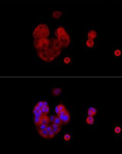 Immunofluorescence analysis of MCF7 cells using Anti-IRS1 Antibody (A12569) at a dilution of 1:100 (40x lens). DAPI was used to stain the cell nuclei (blue).