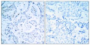 Anti-Estrogen Receptor alpha Rabbit Polyclonal Antibody