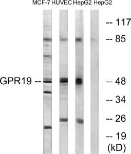 Western blot analysis of lysates from MCF-7, HUVEC, and HepG2 cells using Anti-GPR19 Antibody. The right hand lane represents a negative control, where the Antibody is blocked by the immunising peptide