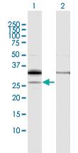 Anti-PPAP2A Rabbit Polyclonal Antibody