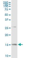 Anti-MDK Polyclonal Antibody Pair