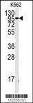 Anti-FGFR1 Rabbit Polyclonal Antibody (AP (Alkaline Phosphatase))