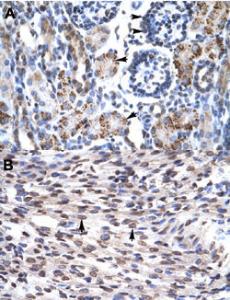 Anti-GFI1B Rabbit Polyclonal Antibody