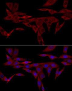 Immunofluorescence analysis of NIH/3T3 cells using Anti-IRS1 Antibody (A12569) at a dilution of 1:100 (40x lens). DAPI was used to stain the cell nuclei (blue).