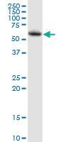 Anti-LPCAT2 Mouse Polyclonal Antibody