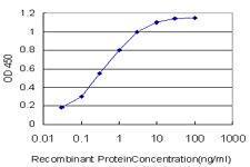 Anti-MDM2 Mouse Monoclonal Antibody [clone: 1A7]