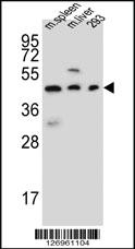 Anti-STEA2 Rabbit Polyclonal Antibody