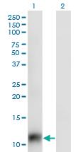 Anti-SNAPC5 Mouse Monoclonal Antibody [clone: 5C3]