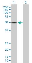 Anti-LPCAT2 Mouse Polyclonal Antibody