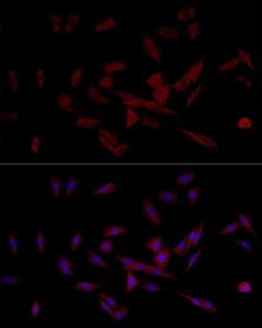 Immunofluorescence analysis of PC-12 cells using Anti-IRS1 Antibody (A12569) at a dilution of 1:100 (40x lens). DAPI was used to stain the cell nuclei (blue).