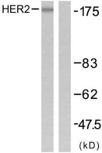 Anti-ErbB 2 Rabbit Polyclonal Antibody