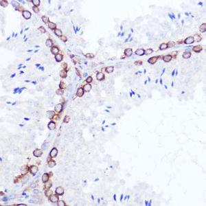 Immunohistochemistry analysis of paraffin-embedded rat testis using Anti-SSR2 Antibody (A305691) at a dilution of 1:100 (40X lens). Perform high pressure antigen retrieval with 10 mM citrate buffer pH 6.0 before commencing with IHC staining protocol