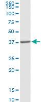 Anti-PPAP2A Rabbit Polyclonal Antibody